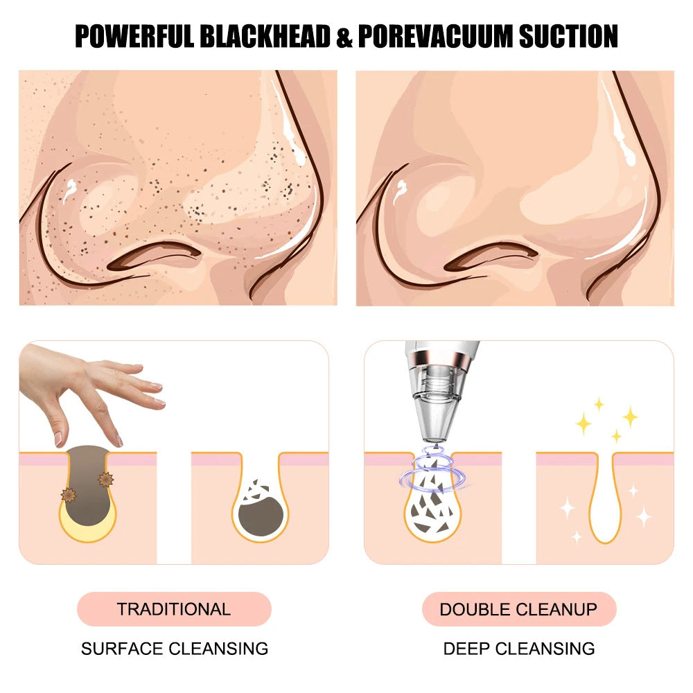 New electric blackhead removal and pore cleaning for blackheads